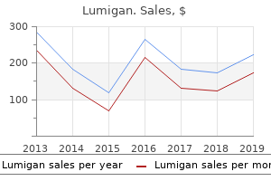 purchase lumigan amex