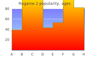 buy rogaine 2 60 ml mastercard